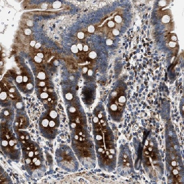 Anti-IL17RC antibody produced in rabbit，100UL，HPA019885-100UL，Sigma