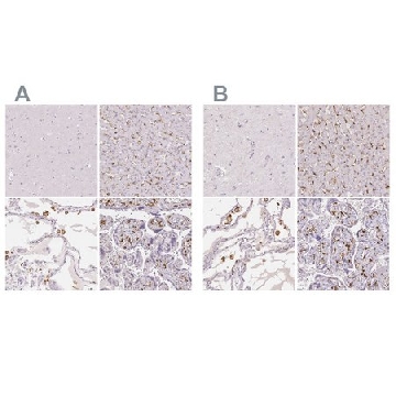 抗-MRC1 兔抗，100UL，HPA004114-100UL，Sigma