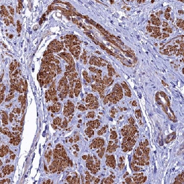 Anti-FADS3 antibody produced in rabbit，100UL，HPA045224-100UL，Sigma