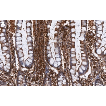 Anti-RIP1/RIPK1 Antibody, clone 1N16 ZooMAb® Rabbit Monoclonal，25UL，ZRB1767-25UL，Sigma
