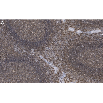 Anti-Talin-1 Antibody, clone 2F8 ZooMAb® Rabbit Monoclonal，25UL，ZRB1361-25UL，Sigma