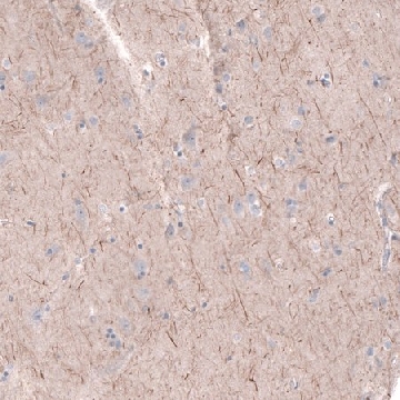 Anti-PTPRK antibody produced in rabbit，100UL，HPA054822-100UL，Sigma