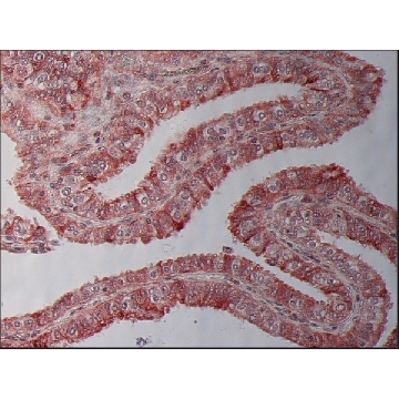 Anti-β-Tubulin I antibody, Mouse monoclonal，100UL，SAB4200732-100UL，Sigma