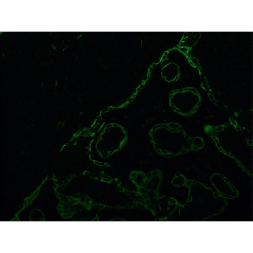 Monoclonal Anti-Cytokeratin Peptide 18 antibody produced in mouse，0.2ML，C1399-.2ML，Sigma