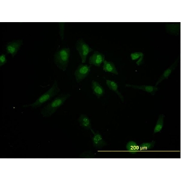 Monoclonal Anti-IRX5 antibody produced in mouse，100UG，WH0010265M1-100UG，Sigma