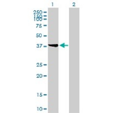 Monoclonal Anti-STYK1 antibody produced in mouse，100UG，WH0055359M1-100UG，Sigma