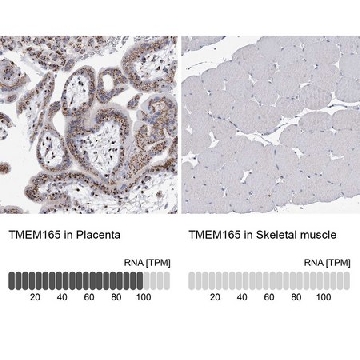 Anti-TMEM165 antibody produced in rabbit，100UL，HPA038299-100UL，Sigma
