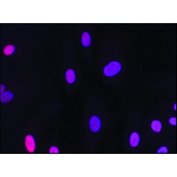 抗  HMGB2 (HMG2) 兔抗，200UL，H9789-200UL，Sigma