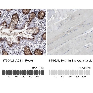 Anti-ST6GALNAC1 antibody produced in rabbit，100UL，HPA014975-100UL，Sigma