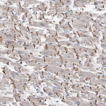 Anti-KLHL7 antibody produced in rabbit，100UL，HPA029491-100UL，Sigma