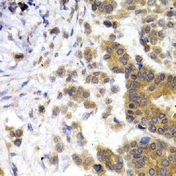 Anti-NEFL antibody produced in rabbit，100UL，SAB5700619-100UL，Sigma