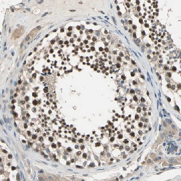 Anti-FAM208A antibody produced in rabbit，100UL，HPA006735-100UL，Sigma