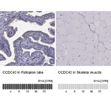 Anti-CCDC40 antibody produced in rabbit，100UL，HPA022974-100UL，Sigma