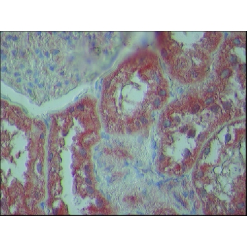 Anti-TDP-43 (N-terminal region) antibody produced in rabbit，200UL，SAB4200006-200UL，Sigma