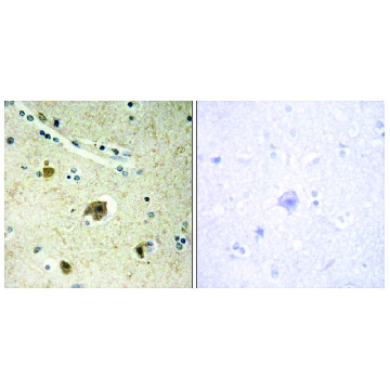 Anti-Collagen IV α4 antibody produced in rabbit，100UG，SAB4500380-100UG，Sigma