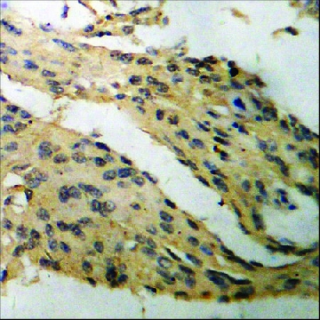 Anti-phospho-Tau (pSer³⁹⁶) antibody produced in rabbit，100UG，SAB4504557-100UG，Sigma