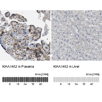Anti-KIAA1462 antibody produced in rabbit，100UL，HPA017956-100UL，Sigma