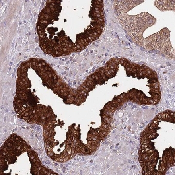 Anti-VWCE antibody produced in rabbit，100UL，HPA043921-100UL，Sigma