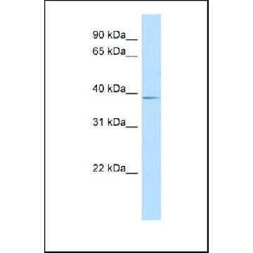 Anti-SLC25A28 antibody produced in rabbit，100UL，SAB2103809-100UL，Sigma