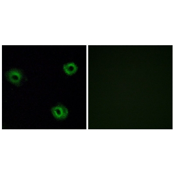 Anti-NTR2 antibody produced in rabbit，100UG，SAB4501016-100UG，Sigma
