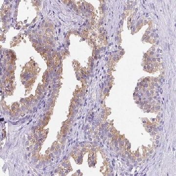 Anti-FAM177A1 antibody produced in rabbit，100UL，HPA053222-100UL，Sigma