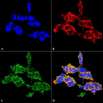 Monoclonal Anti-O-GalNAC-Biotin antibody produced in mouse，100UG，SAB5202339-100UG，Sigma