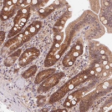 Anti-SLC52A2 antibody produced in rabbit，100UL，HPA063036-100UL，Sigma