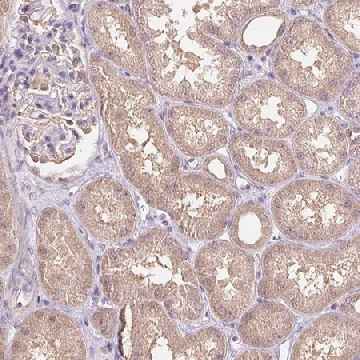 Anti-C10orf128 antibody produced in rabbit，100UL，HPA058166-100UL，Sigma