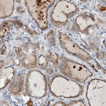Anti-DUOX1 antibody produced in rabbit，100UL，HPA023544-100UL，Sigma