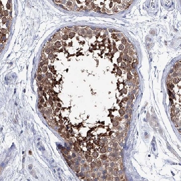 Anti-KLHL17 antibody produced in rabbit，100UL，HPA031251-100UL，Sigma
