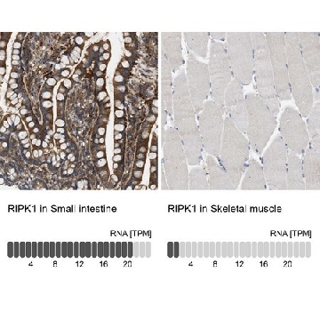 Anti-RIPK1 antibody produced in rabbit，100UL，HPA015257-100UL，Sigma
