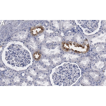 Anti-SLC12A3 Antibody, clone 3I12 ZooMAb® Rabbit Monoclonal，25UL，ZRB1821-25UL，Sigma