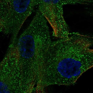 Anti-PDGFRB antibody produced in rabbit，100UL，HPA028499-100UL，Sigma