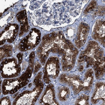 Anti-NEU1 antibody produced in rabbit，100UL，HPA021506-100UL，Sigma