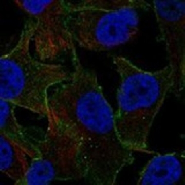 Anti-ARRDC4 antibody produced in rabbit，100UL，HPA039934-100UL，Sigma