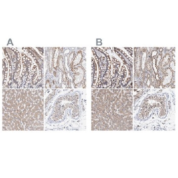 Anti-SGPL1 antibody produced in rabbit，100UL，HPA021125-100UL，Sigma