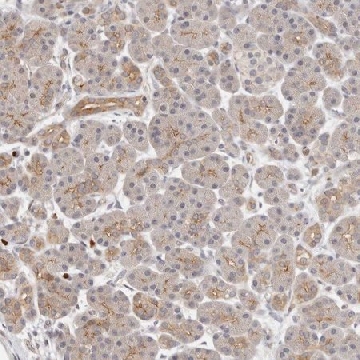 Anti-AFDN antibody produced in rabbit，100UL，HPA030212-100UL，Sigma