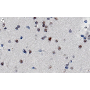 Anti-RBM39 Antibody, clone 1H21 ZooMAb® Rabbit Monoclonal，25UL，ZRB1478-25UL，Sigma