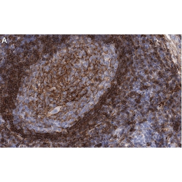 Anti-CD73 (NT5E) Antibody, clone 1F22 ZooMAb® Rabbit Monoclonal，25UL，ZRB1035-25UL，Sigma