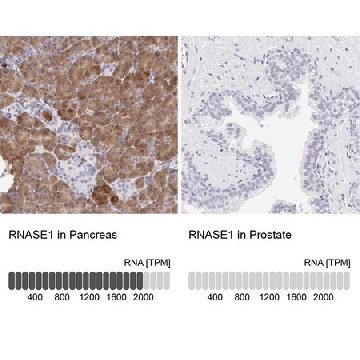 Anti-RNASE1 antibody produced in rabbit，100UL，HPA001140-100UL，Sigma