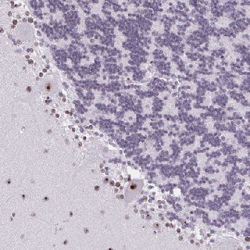 Anti-ZNF800 antibody produced in rabbit，100UL，HPA023090-100UL，Sigma