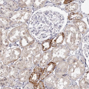Anti-PCDHB6 antibody produced in rabbit，100UL，HPA029566-100UL，Sigma
