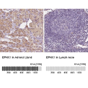 Anti-EPHX1 antibody produced in rabbit，100UL，HPA020593-100UL，Sigma