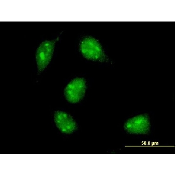 Monoclonal Anti-MAX antibody produced in mouse，100UG，WH0004149M1-100UG，Sigma