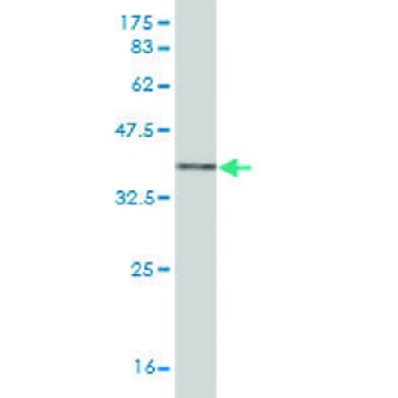 Monoclonal Anti-MMP13 antibody produced in mouse，100UG，WH0004322M7-100UG，Sigma
