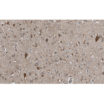 Anti-VGLUT2 Antibody, clone 8G9.2 ZooMAb® Mouse Monoclonal，25UL，ZMS1026-25UL，Sigma