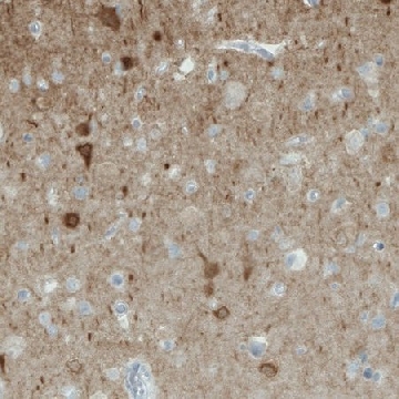 Monoclonal Anti-NECAB1 antibody produced in mouse，100UL，AMAB90800-100UL，Sigma