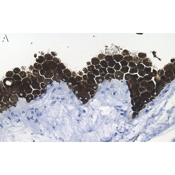 Anti-RPE65 Antibody, clone 401.8B11.3D9 ZooMAb® Mouse Monoclonal，25UL，ZMS1143-25UL，Sigma