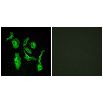 Anti-GPR133 antibody produced in rabbit，100UG，SAB4501242-100UG，Sigma