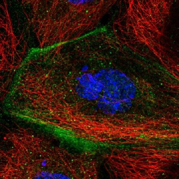 Anti-TMEM63B antibody produced in rabbit，100UL，HPA029250-100UL，Sigma
